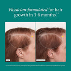 Nutrafol Women’s Balance Hair Growth Supplement 120 Capsules